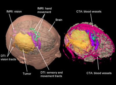 3d-brain-mapping